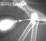 Radiografie-vagin